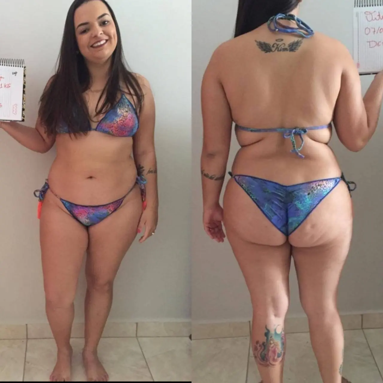 Dra. Vitória - Comparação antes